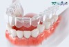 Top 10 địa chỉ niềng răng invisalign tại Thái Bình uy tín nhất Hiệu Quả, An Toàn