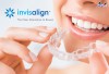 Top 10 địa chỉ niềng răng invisalign tại Vinh Nghệ An uy tín nhất bật mí cho mọi người