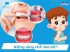 Top địa chỉ niềng răng invisalign tại Cà Mau uy tín nhất mang đến hiệu quả tối đa