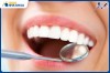 Top 5 địa chỉ niềng răng invisalign tại Đồng Xoài Bình Phước uy tín nhất toàn diện chuyên nghiệp