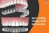 Top 8 địa chỉ niềng răng invisalign tại Phủ Lý Hà Nam uy tín nhất và nổi tiếng hàng đầu