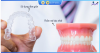 Top 9 địa chỉ niềng răng invisalign tại Bắc Ninh uy tín nhất và chất lượng hàng đầu tại đây