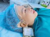 Top 12 Địa chỉ Lào Cai nâng mũi đẹp và an toàn nhất với công nghệ tiên tiến