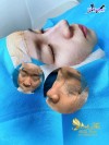 Top 3 Địa chỉ Đông Hà Quảng Trị nâng mũi đẹp và an toàn nhất nhiều chị em tin tưởng