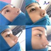 Top 3 Địa chỉ nâng mũi đẹp và an toàn nhất Tân An Long An đội ngũ bác sĩ chất lượng