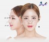 Top 3 Địa chỉ nâng mũi Tây Ninh đẹp và an toàn nhất uy tín nhất (3)