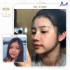 Top 5 Địa chỉ nâng mũi đẹp Pleiku Gia Lai và an toàn nhất vẻ đẹp bền vững