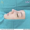 Top 5 Địa chỉ nâng mũi Điện Biên Phủ đẹp và an toàn nhất hiệu quả tối ưu
