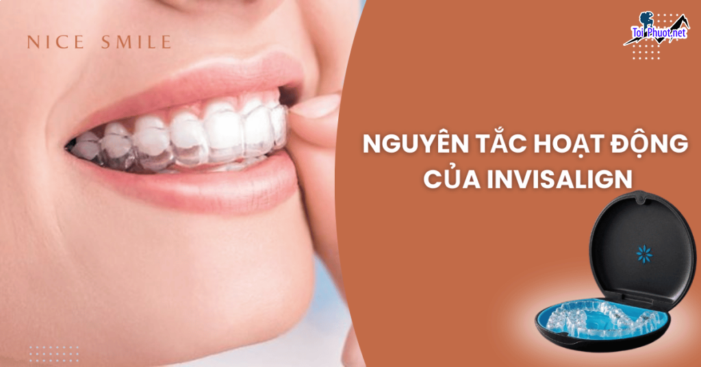 Top 10 địa chỉ niềng răng invisalign tại Buôn Ma Thuột Đắk Lắk uy tín nhất bảng giá mới nhất (2)