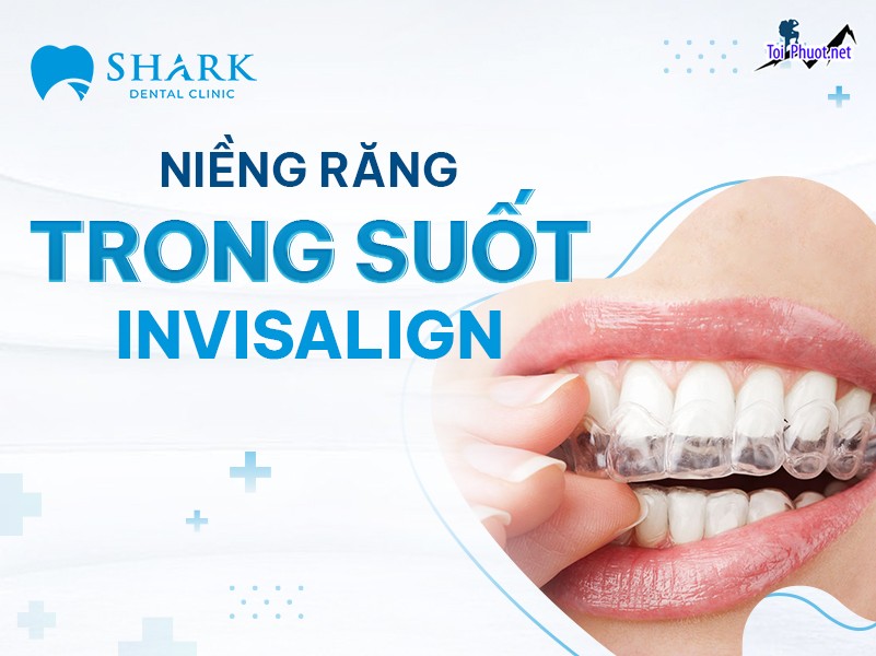 Top 10 địa chỉ niềng răng invisalign tại Sóc Trăng uy tín nhất An Toàn Hiện Nay (3)