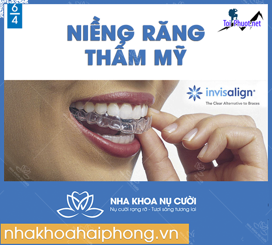 Top 10 địa chỉ niềng răng invisalign tại Thừa Thiên Huế uy tín nhất mang những nụ cười tươi mát, hơi thở thơm tho (1)