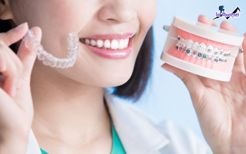 Top 10 địa chỉ niềng răng invisalign tại Thừa Thiên Huế uy tín nhất mang những nụ cười tươi mát, hơi thở thơm tho (2)