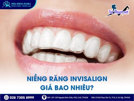 Top 10 địa chỉ niềng răng invisalign tại Thừa Thiên Huế uy tín nhất mang những nụ cười tươi mát, hơi thở thơm tho (3)