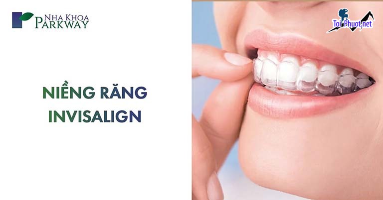 Top 10 địa chỉ niềng răng invisalign tại Trà Vinh uy tín nhất Chất Lượng Tốt – Giá Phải Chăng (2)