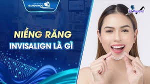 Top 10 địa chỉ niềng răng invisalign tại Trà Vinh uy tín nhất Chất Lượng Tốt – Giá Phải Chăng (4)