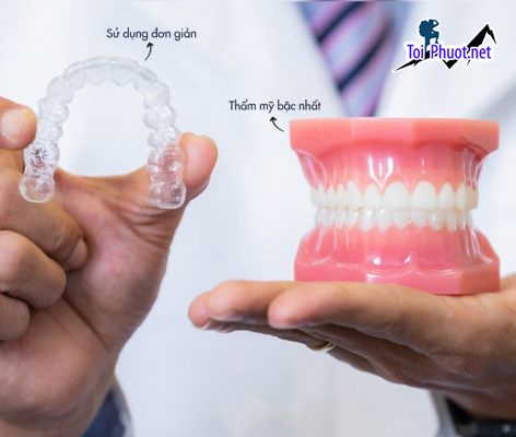 Top 3 địa chỉ niềng răng invisalign tại Ninh Bình uy tín nhất và trách nhiệm cực kì cao (1)