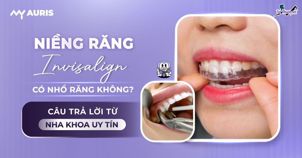 Top 3 địa chỉ niềng răng invisalign tại Ninh Bình uy tín nhất và trách nhiệm cực kì cao (2)