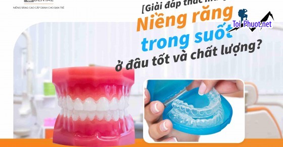 Top 5 địa chỉ niềng răng invisalign tại Biên Hòa Đồng Nai uy tín nhất chất lượng cao về chuyên môn (2)