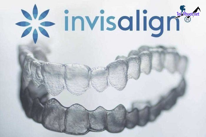 Top 5 địa chỉ niềng răng invisalign tại Cà Mau uy tín nhất mang đến hiệu quả tối đa