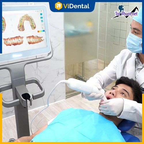 Top 5 địa chỉ niềng răng invisalign tại Hạ Long Quảng Ninh uy tín nhất hỗ trợ tư vấn nhiệt tình (1)