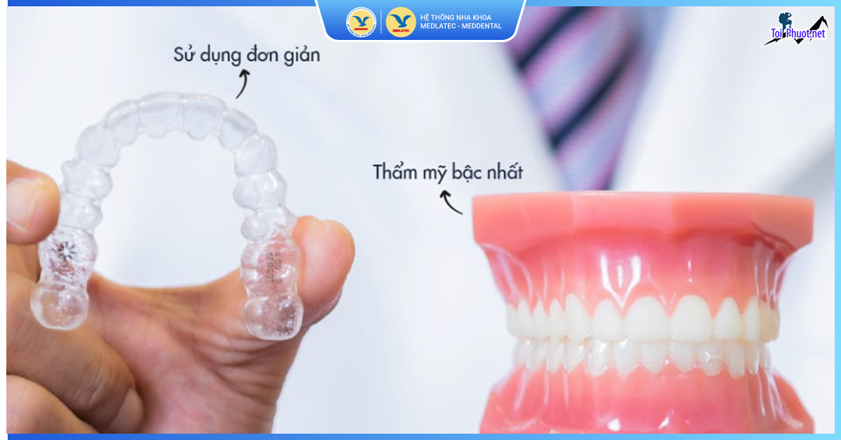 Top 6 địa chỉ niềng răng invisalign tại Đông Hà Quảng Trị uy tín nhất biến nụ cười bạn trở nên hoàn thiện hơn (1)