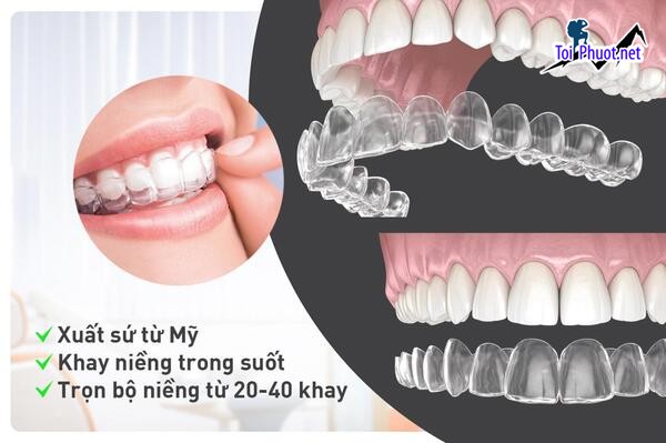 Top 6 địa chỉ niềng răng invisalign tại Lào Cai uy tín nhất cam kết các dịch vụ uy tín (1)