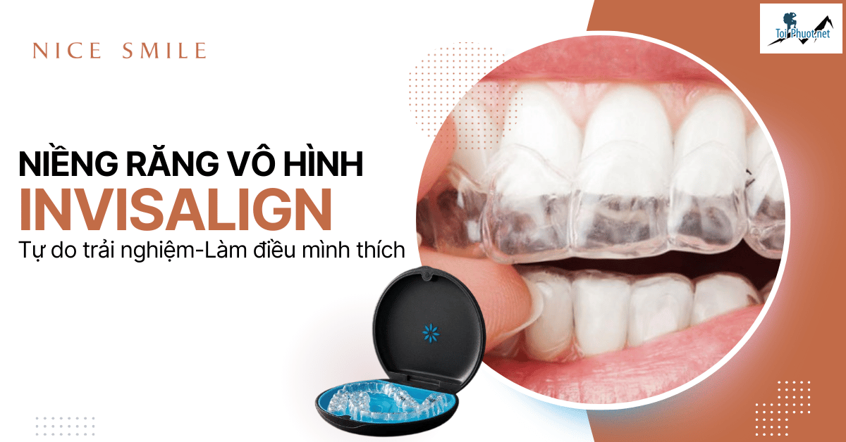 Top 6 địa chỉ niềng răng invisalign tại Lào Cai uy tín nhất cam kết các dịch vụ uy tín (2)