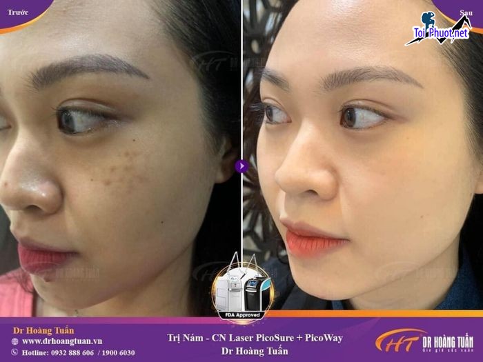 Top 10 Thẩm mỹ viện uy tín và nổi tiếng nhất Hải Phòng Bảo hành lâu dài (4)
