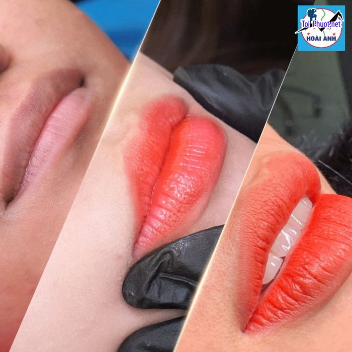 Top 10 Thẩm mỹ viện uy tín và nổi tiếng nhất Thanh Hóa có trình độ cao (1)