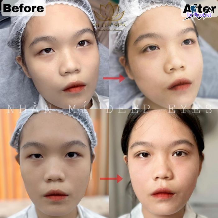 Top 10 Thẩm mỹ viện uy tín và nổi tiếng nhất Thanh Hóa có trình độ cao (2)