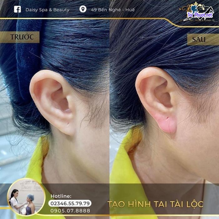 Top 10 Thẩm mỹ viện uy tín và nổi tiếng nhất Thừa Thiên – Huế dịch vụ hàng đầu (1)