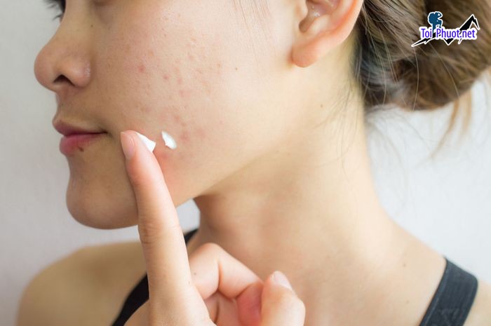 Top 4 Phòng khám da liễu tốt nhất Gia Lai luôn được đánh giá cao (1)