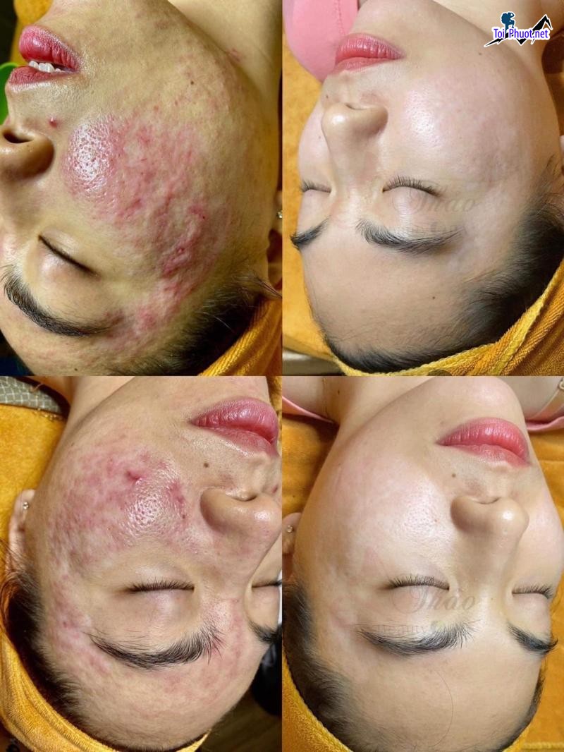 Top 5 Trung tâm dạy nghề spa uy tín và chất lượng nhất Lai Châu chất lượng tốt (2)