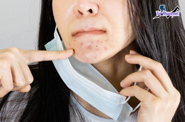 Top 6 Phòng khám da liễu tốt nhất Sơn La quy trình khám nhanh chóng