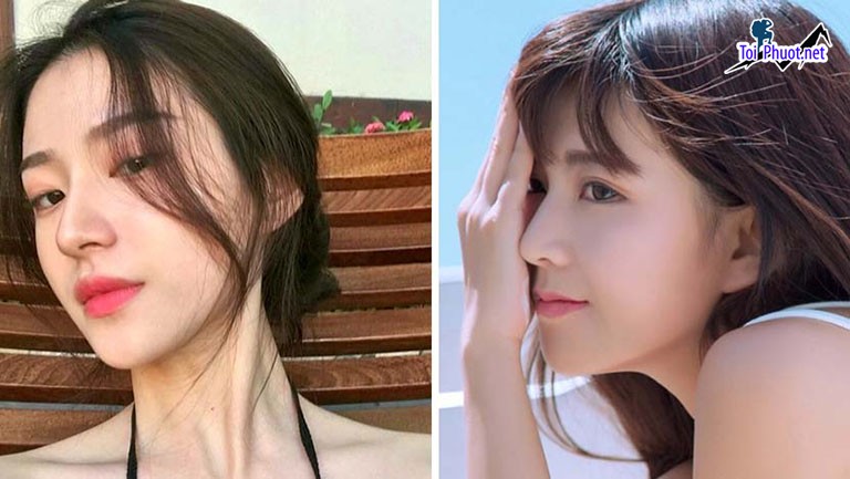 Top 12 Địa chỉ Lai Châu nâng mũi đẹp và an toàn nhất phù hợp khuôn mặt (1)