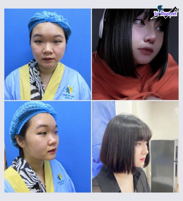 Top 12 Địa chỉ Lào Cai nâng mũi đẹp và an toàn nhất với công nghệ tiên tiến (1)