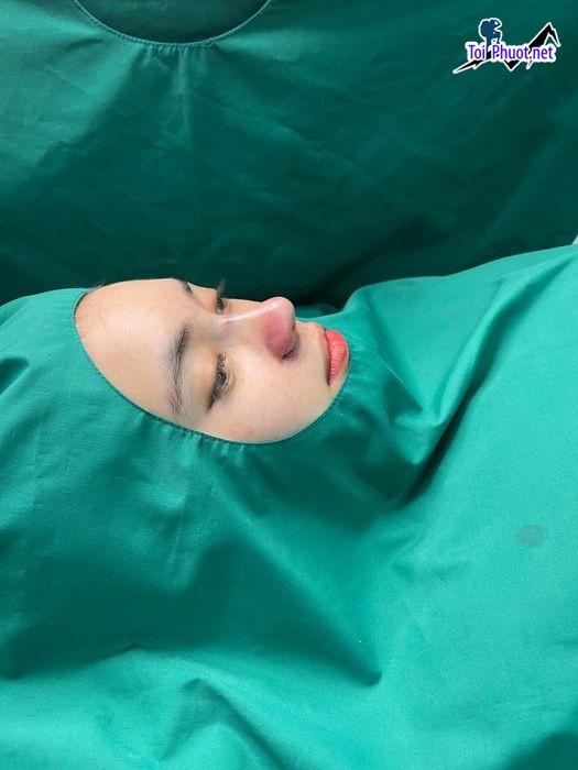 Top 12 Địa chỉ Lào Cai nâng mũi đẹp và an toàn nhất với công nghệ tiên tiến (4)