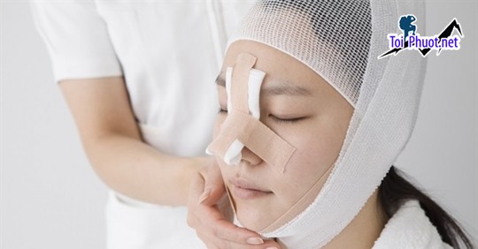 Top 12 Địa chỉ nâng mũi đẹp và an toàn nhất Hải Dương dáng mũi chuẩn đẹp (1)