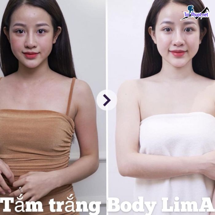 Top 5 Thẩm mỹ viện uy tín và nổi tiếng nhất Vĩnh Long hiệu quả toàn diện (2)