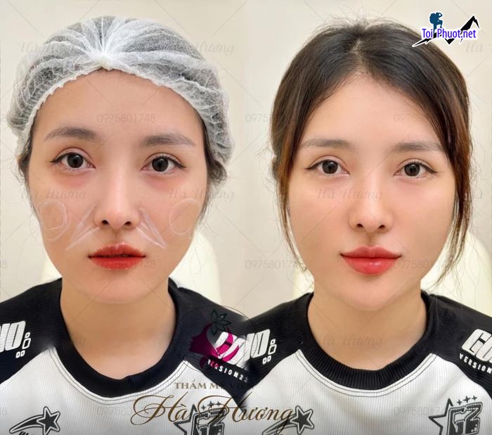 Top 6 Thẩm mỹ viện uy tín và nổi tiếng nhất Đồng Tháp đặt trọn niềm tin (1)