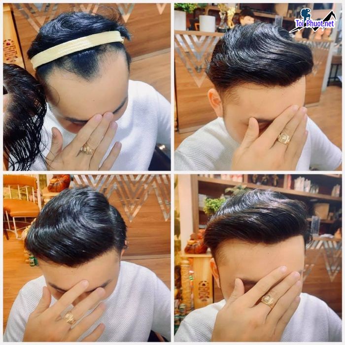 Top 3 Cửa hàng bán tóc giả chất lượng nhất Mỹ Tho Tiền Giang Phối Tóc Giả An Toàn (3)