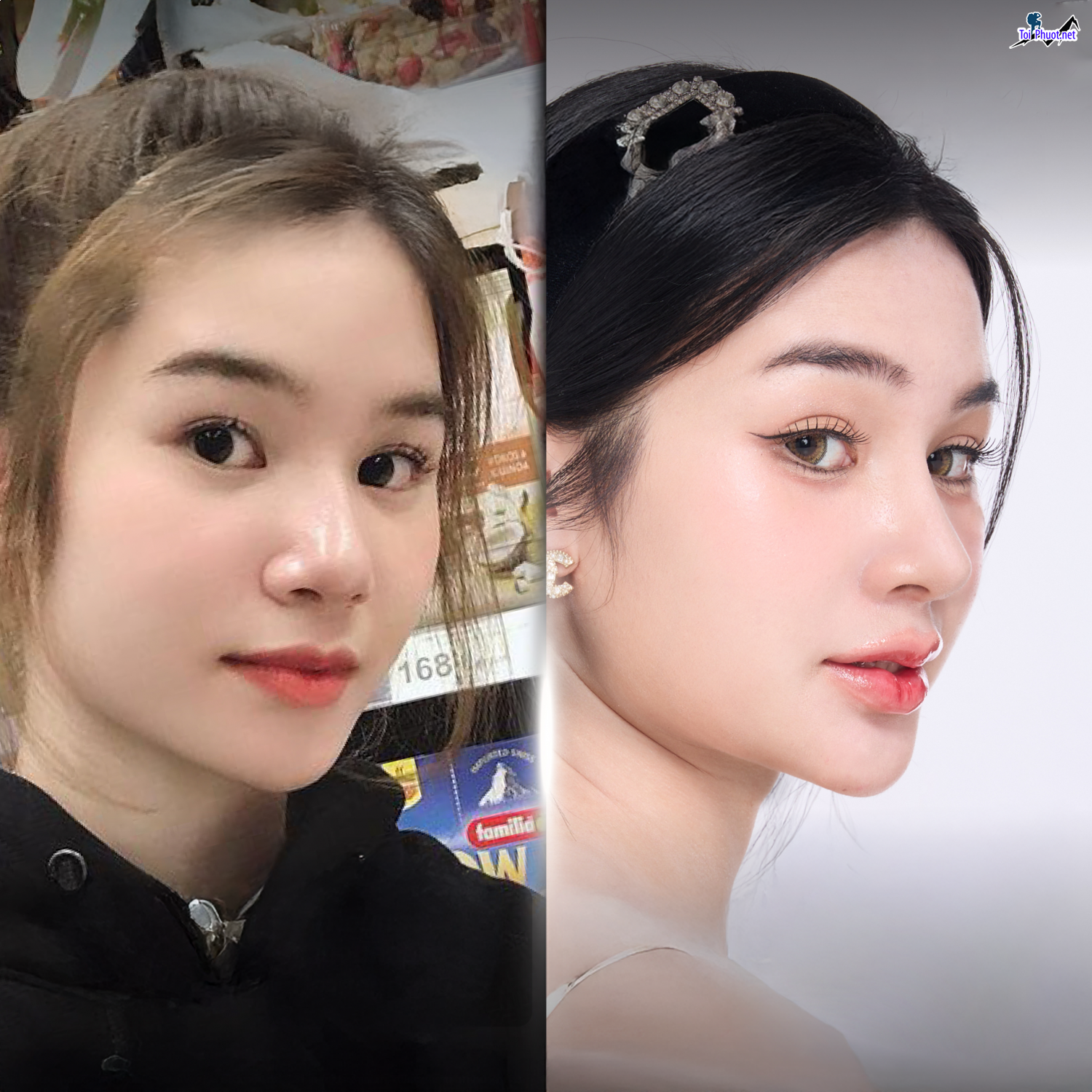 Top 5 Địa chỉ nâng mũi đẹp và an toàn nhất Thủ Dầu Một Bình Dương đảm bảo cho sức khỏe (1)